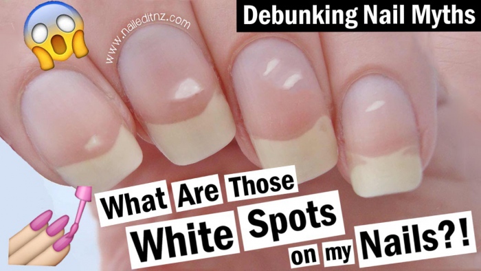 White Spots On Your Nails