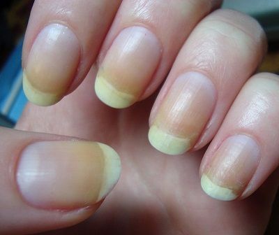 Orange Yellow Fingernails