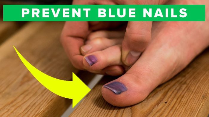 How To Prevent Blue Toe Nails